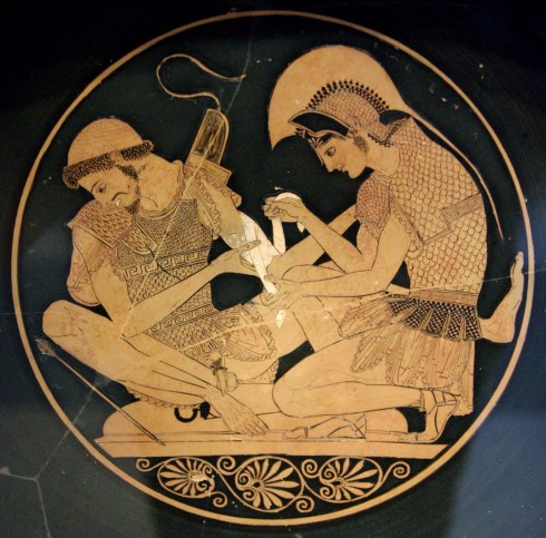 C02.Aquiles y Patroclo